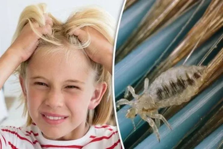 What hairstyles do lice hate