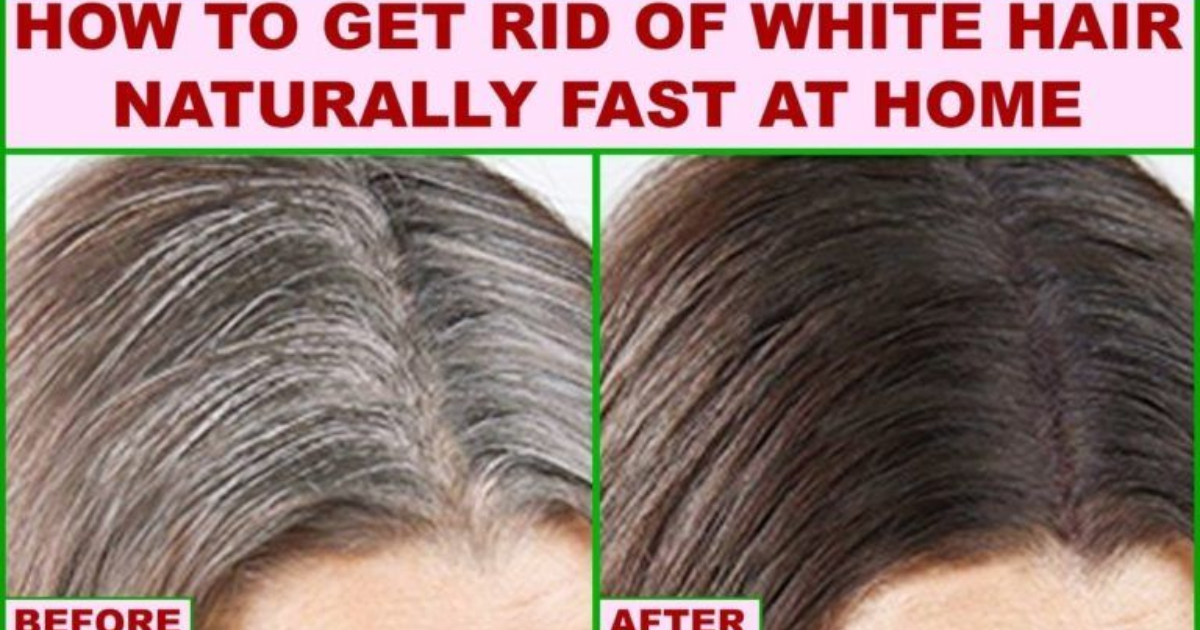 Causes Of White Hair And Easy Ways To Prevent It Naturally: Top Tips!